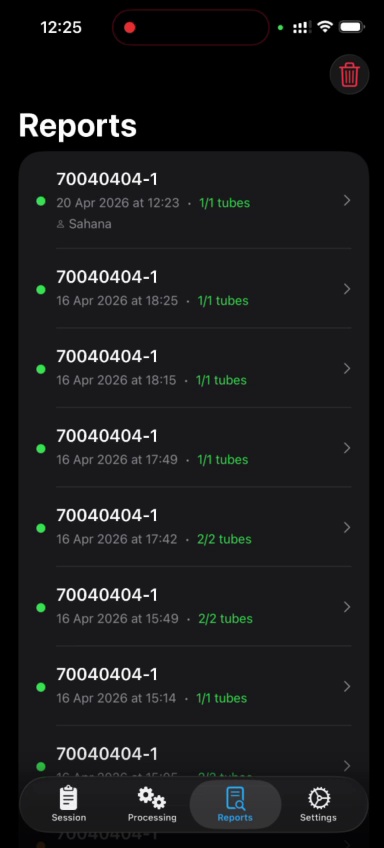 Stamp inspection — live detection on a metal tube with bounding boxes